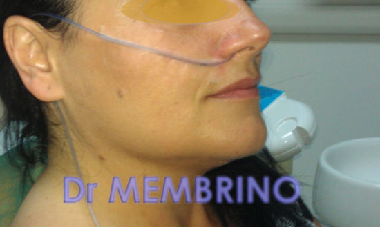 STUDIO MEDICO DR MEMBRINO - PERCHE' METTERE IL SONDINO PER DIMAGRIRE